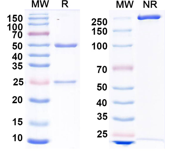 SDS-PAGE for Anti-Influenza A virus NP/Nucleoprotein Antibody (SAA0411).