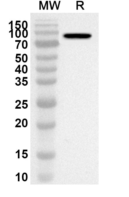 Western blot analysis was performed using anti-Influenza A virus NP/Nucleoprotein polyclonal antibody at 1ug/mL on recombinant Influenza A virus NP/Nucleoprotein (Catalog No. VK528022).