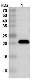 Western blot analysis was performed using anti-Matrix-CHPV polyclonal antibody at 1ug/mL on various samples.
Lane 1: recombinant CHPV M/Matrix protein (Catalog No: VK535012)