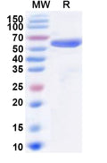Recombinant PDCoV NSP3/PL-PRO Protein, N-His