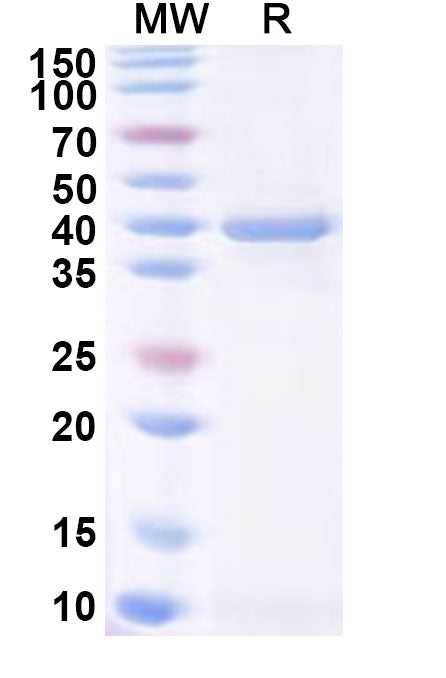 Recombinant PDCoV NSP7 Protein, N-GST & C-His