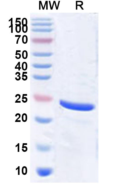 Recombinant PDCoV NSP8 Protein, N-His