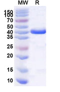 Recombinant PDCoV NSP9 Protein, N-GST & C-His