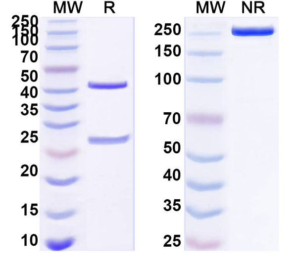 SDS-PAGE for Anti-HBV HBsAg Monoclonal Antibody (1A235)
