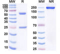 Anti-HBsAg Reference Antibody (Tuvirumab) – Figure 1 of 1