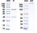 SDS-PAGE for Anti-Pan HBV S/L-HBsAg/L glycoprotein Antibody (KR127).
