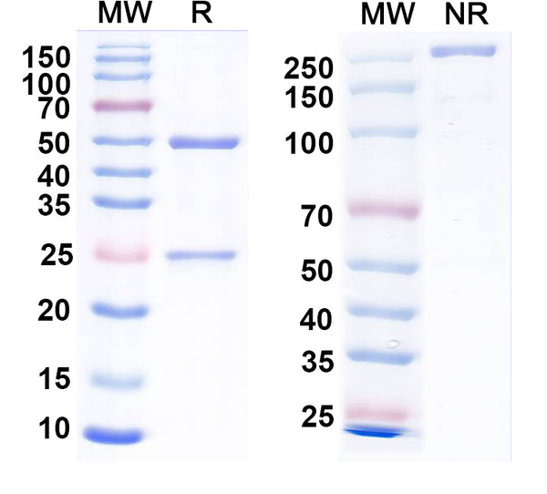 SDS-PAGE for Anti-Pan HBV S/L-HBsAg/L glycoprotein Antibody (KR127).