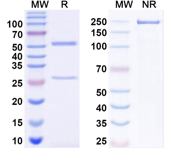 SDS-PAGE for Anti-HBV HBsAg Monoclonal Antibody (1A236)