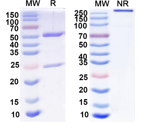 SDS-PAGE for Anti-HBV S/L-HBsAg/L glycoprotein Antibody (G10).