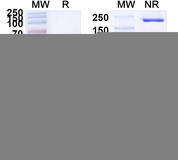 SDS-PAGE for InVivoMAb Anti-HBV-A S/L-HBsAg/L glycoprotein Antibody (Iv0189)