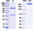 SDS-PAGE for Anti-HBV preS2 domain Antibody (F124)
