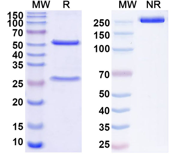 SDS-PAGE for Anti-HBV preS2 domain Antibody (F124)