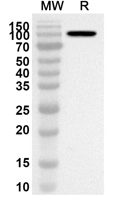 Western blot analysis was performed using anti-HAdV-5 L3/CP-H/Protein II polyclonal antibody at 1ug/mL on recombinant HAdV-5 L3/CP-H/Protein II (Catalog No. VK540012).