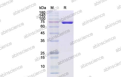 SDS-PAGE for M-MLV Reverse Transcriptase