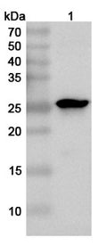 Western blot analysis was performed using anti-P-CHPV  polyclonal antibody at 1ug/mL on various samples.
Lane 1: recombinant CHPV P/Phosphoprotein (Catalog No: VK546012)