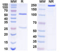 SDS-PAGE for Anti-West Nile virus/WNV GP1/Genome polyprotein Antibody (CR4374)