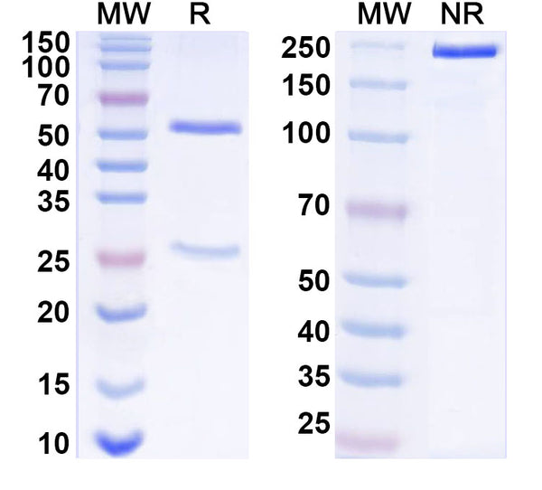SDS-PAGE for Anti-West Nile virus/WNV GP1/Genome polyprotein Antibody (CR4374)