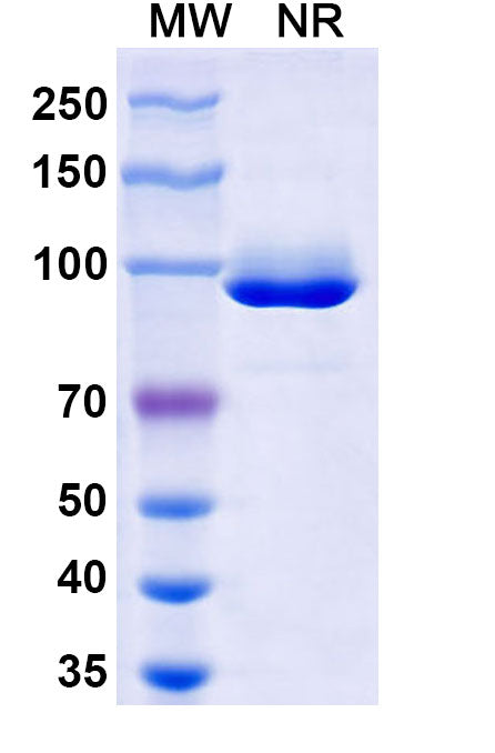 SDS-PAGE for Anti-HPV16 E7/Protein E7 Antibody (Nb2).