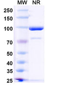 SDS-PAGE for Anti-HPV16 E7/Protein E7 Antibody (Nb27)