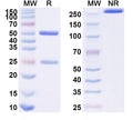 SDS-PAGE for Anti-HPV18 E7/Protein E7 Antibody (SAA2229)
