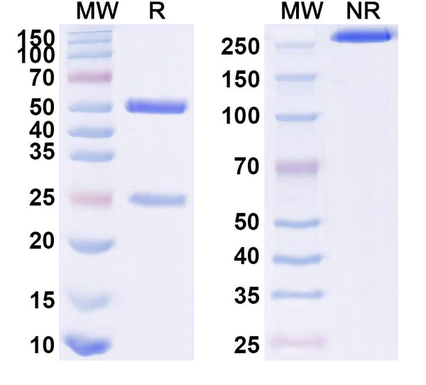 SDS-PAGE for Anti-HPV18 E7/Protein E7 Antibody (SAA2229)