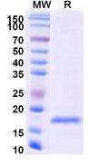 Recombinant Monkeypox virus/MPXV A36R Protein, N-His
