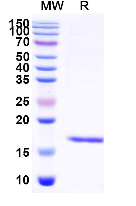 SDS-PAGE for Anti-Influenza A virus RNA polymerase complex Nanobody (SAA2270)