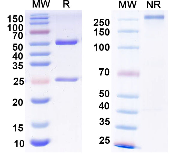 SDS-PAGE for Anti-HRSV-A G/Major surface glycoprotein G Antibody (2D10).