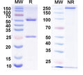 SDS-PAGE for Anti-HRSV-A G/Major surface glycoprotein G Antibody (3D3).