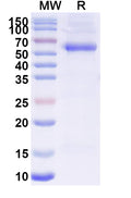 Recombinant PEDV S/Spike glycoprotein Protein, C-His