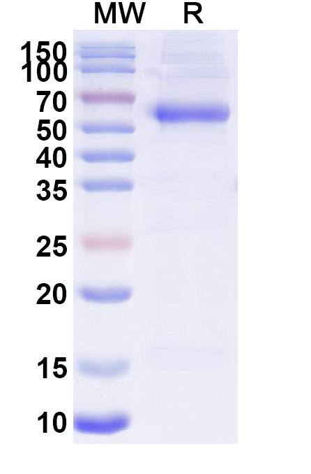 Recombinant PEDV S/Spike glycoprotein Protein, C-His