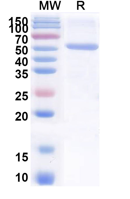 Recombinant PEDV S1/Spike glycoprotein 1 Protein, N-His & C-His