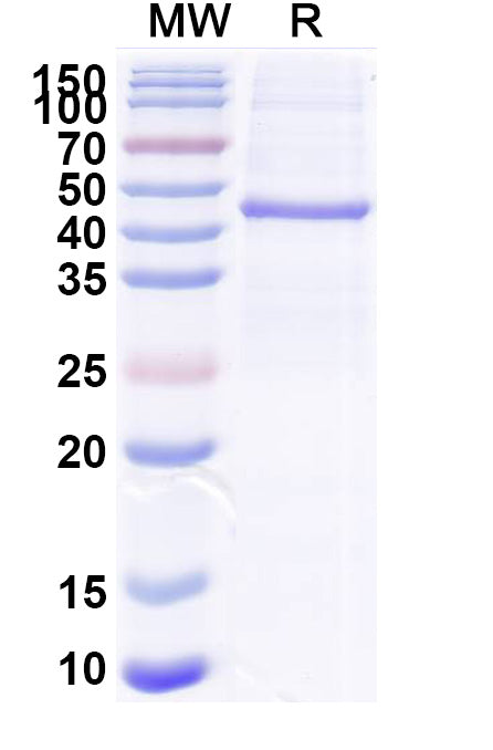 Recombinant PEDV S2/Spike glycoprotein 2 Protein, N-His & C-His
