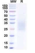Recombinant PEDV Spike glycoprotein (RBD) Protein, C-His
