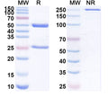 Detects Recombinant SARS-CoV-2 Spike protein receptor binding domain (Cat No.: VK565021) in indirect ELISA.