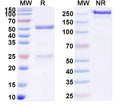 SDS-PAGE for Anti-SARS-CoV-2 RBD Antibody (CR3022).
