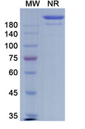 Anti-SARS-CoV-2 (2019-nCoV) RBD Reference Antibody (Casirivimab) – Figure 1 of 2