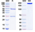 SDS-PAGE for Anti-SARS-CoV-2 RBD antibody (1B6).