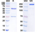 SDS-PAGE for Anti-SARS-CoV-2 RBD antibody (1E4#).