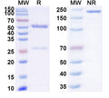 SDS-PAGE for Anti-SARS-CoV-2 RBD antibody (2A93).