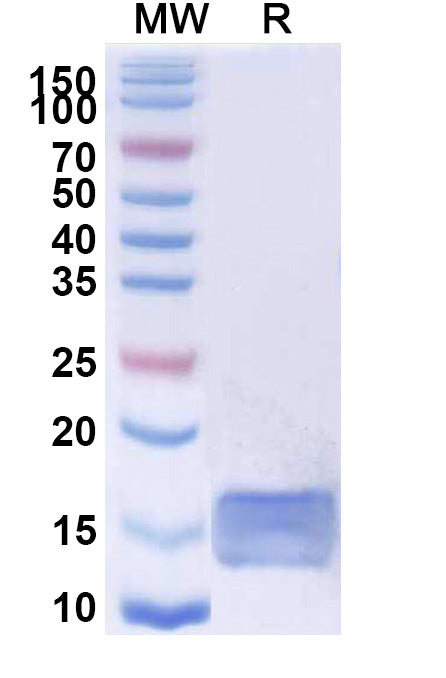 SDS-PAGE for Anti-SARS-CoV-2 RBD Nanobody (VHH-72)
