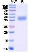Recombinant SARS-CoV-2 Spike (RBD) Protein (BA.2.86), C-His