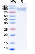 Recombinant ASFV CD2v/pEP402R/CD2H Protein, C-Fc
