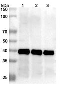 Western blot analysis was performed using anti-Mojiang virus fusion protein polyclonal antibody at 1μg/ml on various samples.
Lane 1: recombinant Mojiang virus/MojV F/Fusion glycoprotein F0 (Catalog No: VK570022), 70 ug
Lane 2: recombinant Mojiang virus/MojV F/Fusion glycoprotein F0 (Catalog No: VK570022), 50 ug
Lane 3: recombinant Mojiang virus/MojV F/Fusion glycoprotein F0 (Catalog No: VK570022), 30 ug