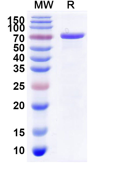 Recombinant CHIKV Spike glycoprotein E2 Protein, C-Fc