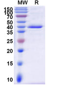 Recombinant CHIKV Spike glycoprotein E2 Protein, C-His