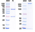 SDS-PAGE for Anti-CHIKV Spike glycoprotein E2 Antibody (4J21)