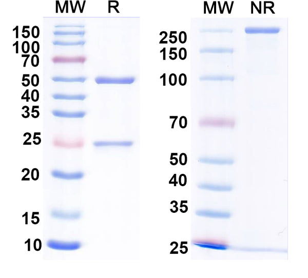 SDS-PAGE for Anti-CHIKV Spike glycoprotein E2 Antibody (4J21)