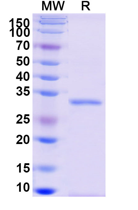 Recombinant Monkeypox virus/MPXV A14L Protein, N-GST & C-His