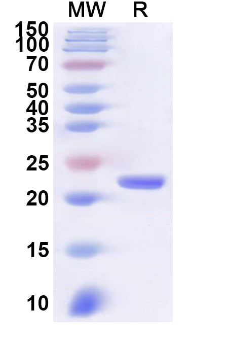 Recombinant CVA6 P3C/Protease 3C Protein, N-His